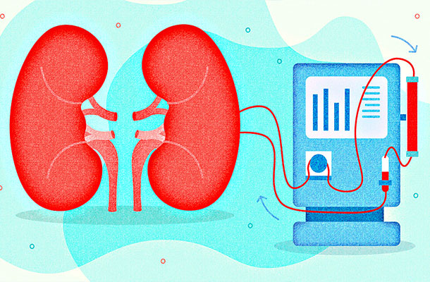 Hemodiyaliz Nedir ?